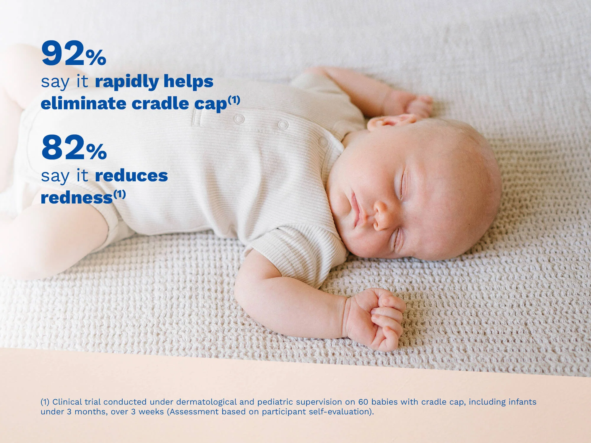 Cradle cap cream - Image 2